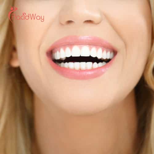 Cross-Border Convenience: Why Slovenian Patients are Flocking to Croatia for Advanced Same-Day Smile Makeovers